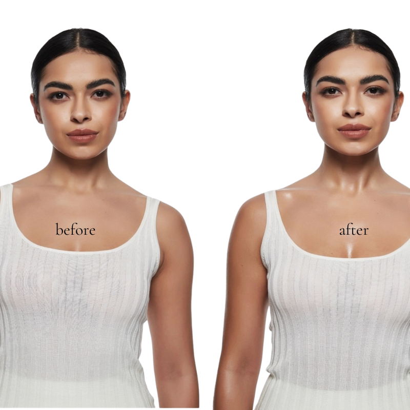 Before and after comparison of Body Glow Lotion showing instant radiant skin and natural hydrating effect on neck and décolleté.