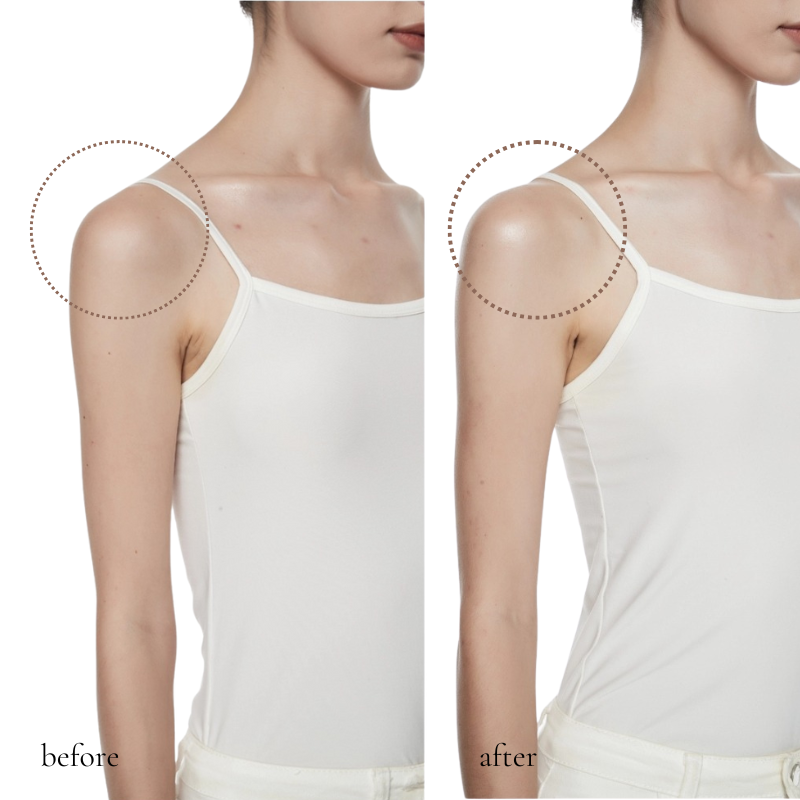 Before and after comparison of Body Shimmer Lotion showing instant radiant skin and natural shimmer effect on shoulders.