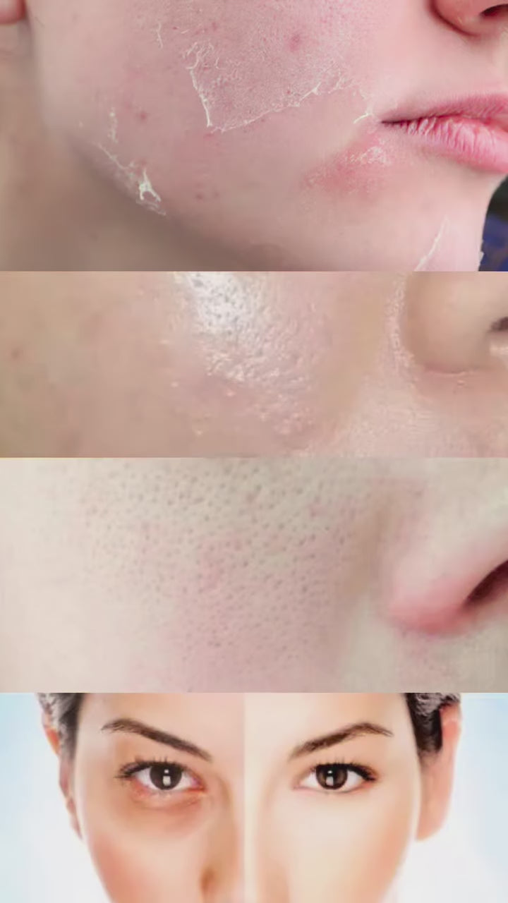 SOSO hydrating and smoothing sheet mask ad showing skin concerns, serum-soaked mask, key ingredients, and glowing skin results.